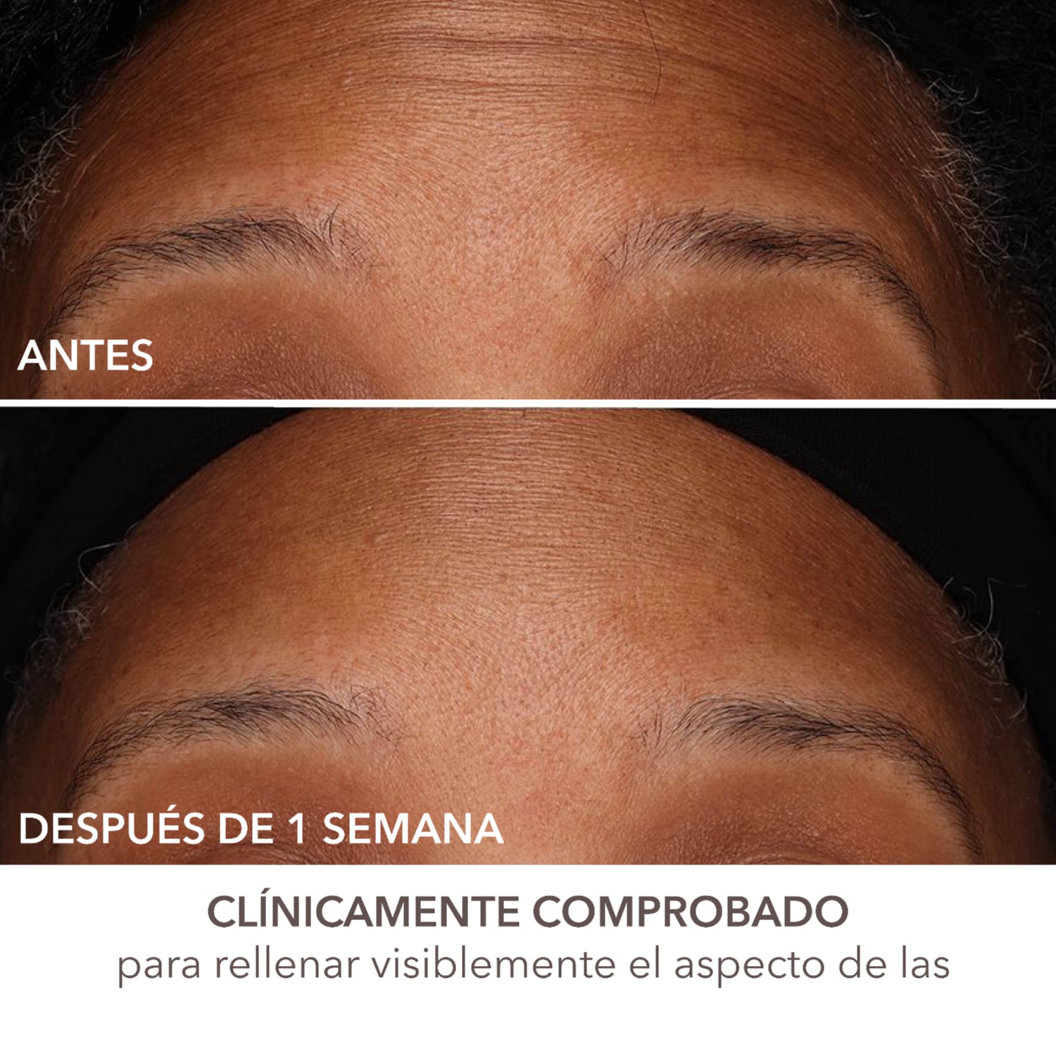 DERMINFUSIONS ™ FILL + REPAIR SERUM (SUERO PARA ROSTRO)